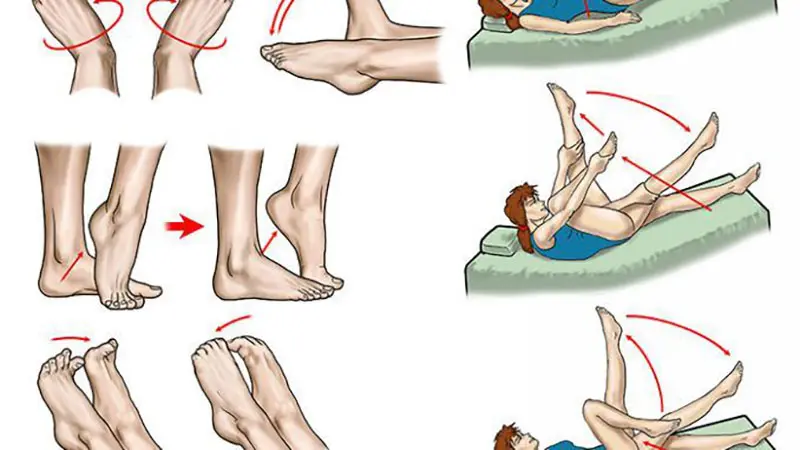 تمارين تساعد على تقليل دوالي الساقين