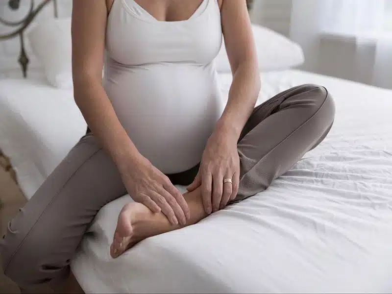 نصائح للحامل لتجنب دوالي الساقين