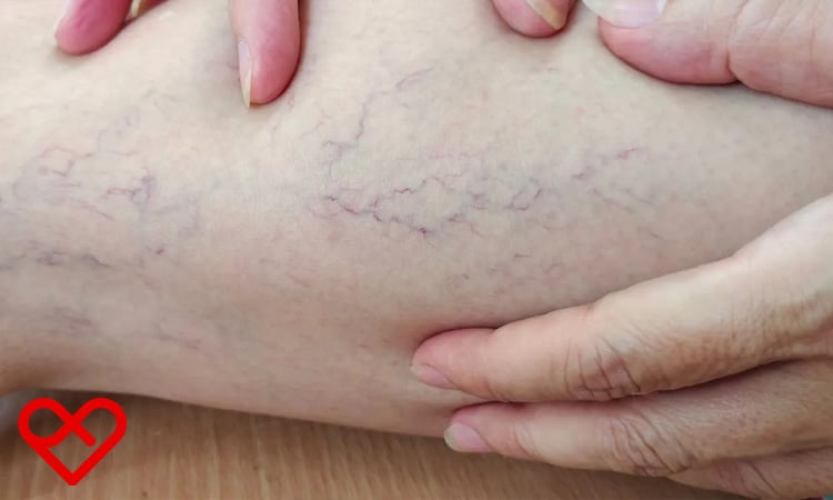 نصائح قبل و بعد العلاج